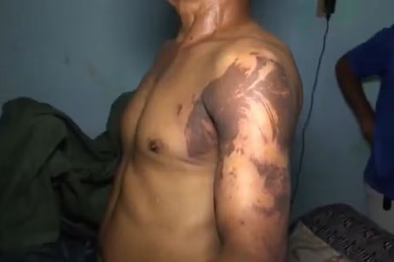 Mãe e filho são transferidos para Salvador após ataque com líquido corrosivo em Itabuna, Vítimas foram encaminhadas ao Hospital Geral do Estado (HGE) devido à gravidade dos ferimentos; suspeito permanece preso e caso segue sob investigação da Polícia Civil.